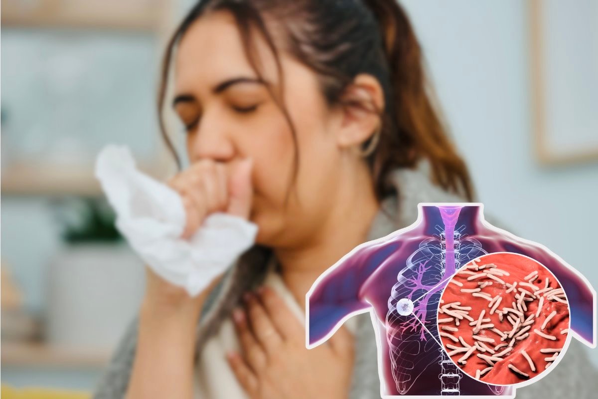 Chiapas reporta más de 100 casos de tuberculosis respiratoria